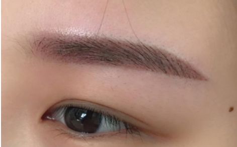 杭州哪家醫(yī)院做隆胸效果好？