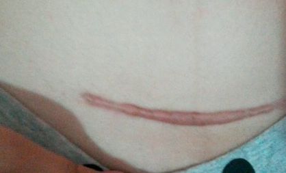 南京激光祛皺紋哪家醫(yī)院好？探尋南京最受歡迎的激光祛皺紋醫(yī)院