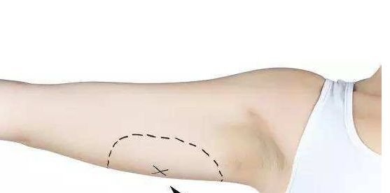 南京去除黃褐斑醫(yī)院排名及口碑，哪家值得信賴？