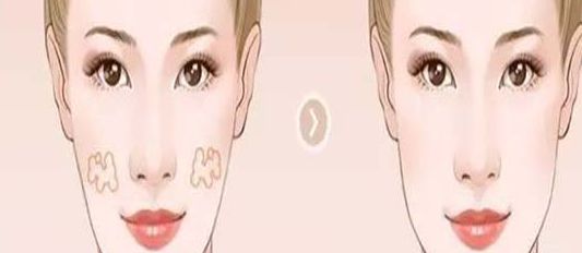 南京哪家醫(yī)院的小陰唇整形效果好？