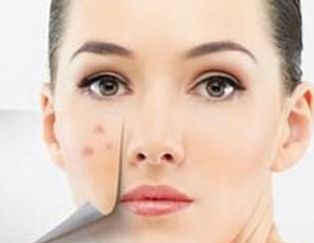 廈門哪家醫(yī)院墊鼻子好？專家推薦的Top5廈門墊鼻子好醫(yī)院