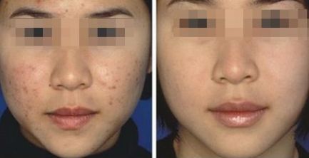 連云港眼部激光飛秒那家好？排名領(lǐng)先的專業(yè)眼科醫(yī)院推薦