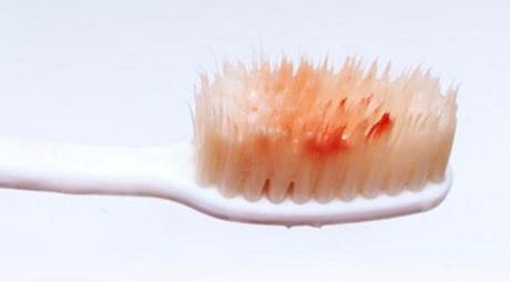 2023西安熱瑪吉消除眼部細(xì)紋專家上榜清單前10位(肖志華、雷靜、陳偉讓整形更有保障)