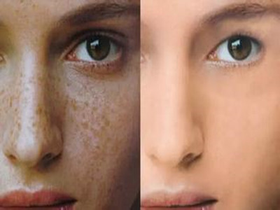 2023廣西面部提拉微整形榜單top10強(qiáng)醫(yī)生(梁東、張奕梅、蒙誠躍口碑好，人氣也很旺！)