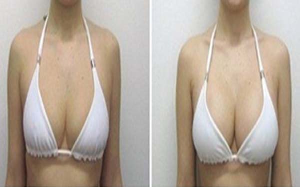 2023西安電波拉皮去蝴蝶斑專(zhuān)家排行榜前十(王瑞、盧丙侖、王曉鵬上榜的都是高人氣醫(yī)生列表！)