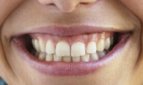 2023重慶去眼角紋排名榜前10醫(yī)生(張國輝、晏傳濤、薛蓮群全新案例公布)