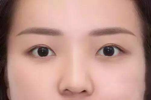 2023長治熱瑪吉祛疤專家推薦前十(田書強、李學雷、董琦這些醫(yī)生更靠譜，更放心！)