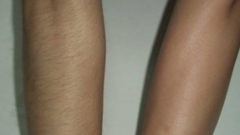 商丘杜韓整形醫(yī)院和華美之間如何選擇？雙眼皮手術(shù)價(jià)格一覽表