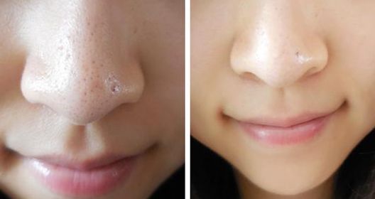 沈陽沈河華顏美整形美容醫(yī)院怎么樣？沈陽沈河華顏美整形美容醫(yī)院簡介|醫(yī)生團隊|口碑評價！