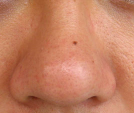 2023重慶內(nèi)路法祛眼袋專家前十強(qiáng)強(qiáng)榜(郭銳、李玲玲、鄭楠專家大咖技術(shù)過(guò)硬)