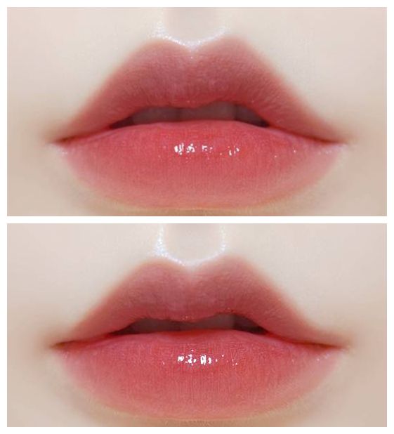 揭秘上海注射玻尿酸醫(yī)院排行榜，哪家好的口碑最高？