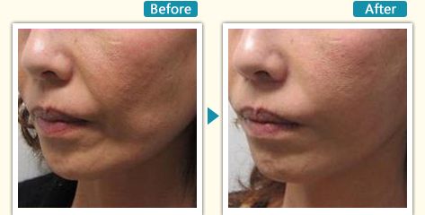 杭州哪家瘦腿針醫(yī)院好？全面解析杭州最受用戶歡迎的瘦腿針醫(yī)院推薦