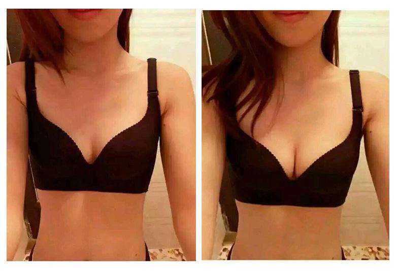 2023廣州熱瑪吉去頸部皺紋正規(guī)專家排行榜TOP10(鄭燕妮、張永義、喬鋒麗技術(shù)及個(gè)人簡(jiǎn)介一覽)