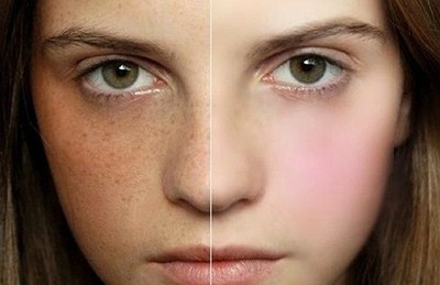 2023太原水光針去除動(dòng)態(tài)細(xì)紋權(quán)威專(zhuān)家榜單前幾(原晶晶、薄曉茹、富秋濤口碑反饋)