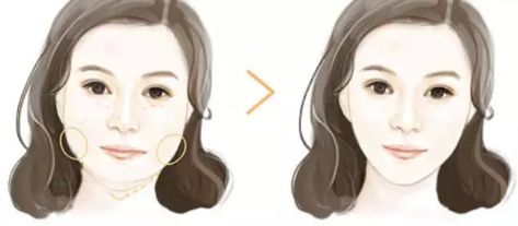 上海哪家下頜骨醫(yī)院好？解析上海下頜骨疾病常見病例及專業(yè)治療！