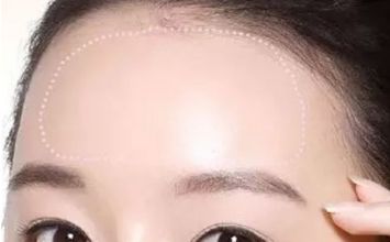 蘇州哪家黃褐斑醫(yī)院好？專業(yè)醫(yī)生推薦，讓你告別黃褐斑困擾！