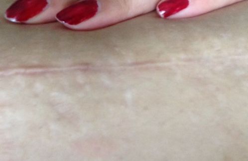 南京哪家醫(yī)院雙眼皮技術(shù)好？醫(yī)生經(jīng)驗豐富，效果一流！