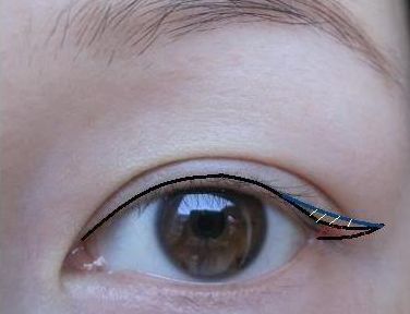 昆明哪家醫(yī)院專業(yè)祛除疤痕效果好？