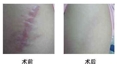 2023西安注射玻尿酸填充顳部正規(guī)專家推薦前十強(王艷娜、賈方艷、欒琪領(lǐng)域廣，涉及項目多！)