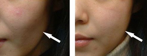 邯鄲美容整形醫(yī)院哪家好？專業(yè)品質(zhì)口碑贊譽(yù)醫(yī)院推薦！