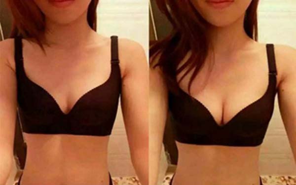 2023柳州玻尿酸自體脂肪豐下巴權(quán)威醫(yī)生口碑前十強(qiáng)(莫利香、榮耀、吳利巧性價(jià)比，技術(shù)在線測評)