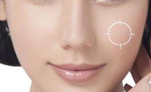 2023貴州激光修復(fù)靜態(tài)紋口碑專家(梁安裕、張小玲、陳璐一起來(lái)瞧瞧實(shí)力高低~)