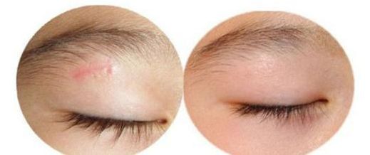 上海顴弓手術(shù)哪家醫(yī)院效果好，專(zhuān)家推薦