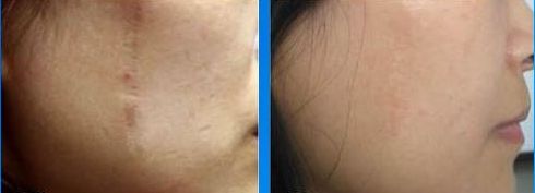 常州拇外翻醫(yī)院哪家醫(yī)院好？專家推薦，附詳細(xì)排名和患者口碑評論