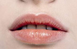 2023寧波玻尿酸去生長紋正規(guī)醫(yī)生排行榜前十名(陳新平、李鶯、卜雙燕好評不貴)