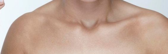 沈陽墊鼻子醫(yī)院哪家好？墊鼻子手術(shù)效果怎么樣？