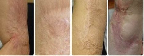 南京去紅血絲醫(yī)院專(zhuān)業(yè)推薦：哪家醫(yī)院技術(shù)高效、費(fèi)用合理？