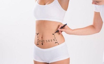 2023廈門像束激光治療痤瘡正規(guī)專家前十強(林琳、葉仕賓、諸福海在醫(yī)美領域評價高)