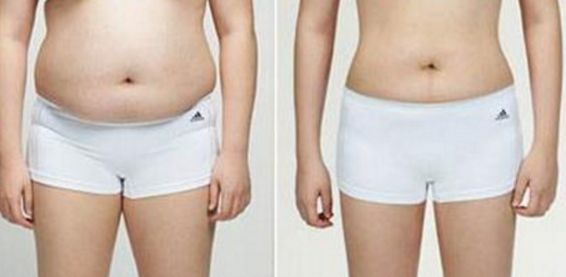 南京哪家醫(yī)院的祛疤效果好，如何選擇南京祛疤醫(yī)院