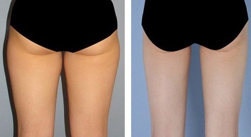 北京治療痘痘好的醫(yī)院排名推薦