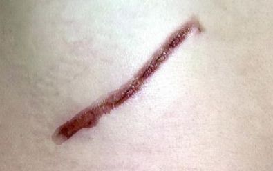 探尋開封市美容醫(yī)院的排名與口碑，哪家值得信賴？