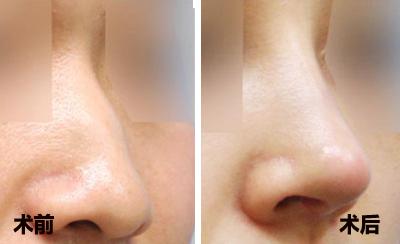 2023云南黑痣切除正規(guī)醫(yī)生推薦TOP10(郝珺珺、宋晉明、江春光都有實力)