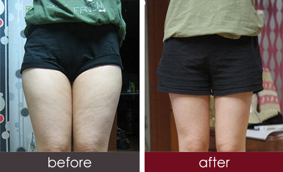 2023湖北淚溝紋填充權(quán)威專家評分前十(邵婕、雷鐵池、雷新明口碑審美雙在線)