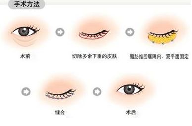 南寧治療痘印哪家醫(yī)院靠譜？—用戶首選南寧去痘印醫(yī)院排行榜