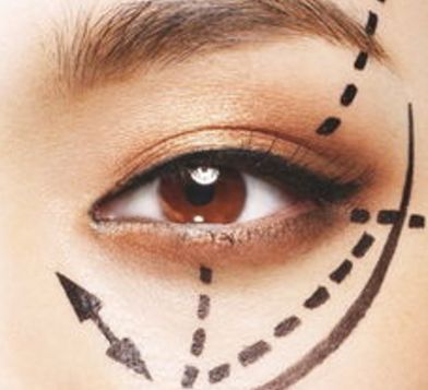 蘭州眼睛美容醫(yī)院哪家好？揭秘蘭州市最受歡迎的眼睛美容醫(yī)院排行榜！