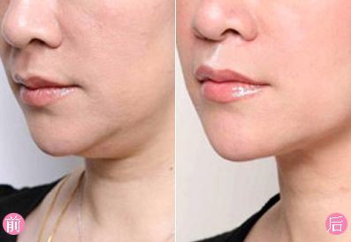 瀘州去疤痕哪家醫(yī)院好？疤痕修復盡在XXX?？漆t(yī)院！