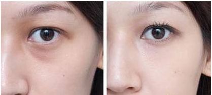 杭州哪家醫(yī)院做狐臭手術好且靠譜？