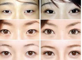 武漢去眼袋哪家好可信？揭秘眼袋整形專家推薦排行榜！