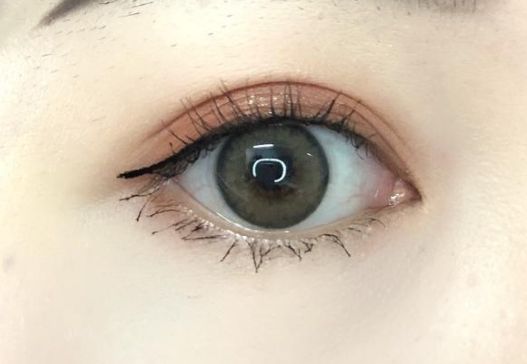 重慶去疤痕醫(yī)院有哪些專家？哪家去疤痕醫(yī)院好？