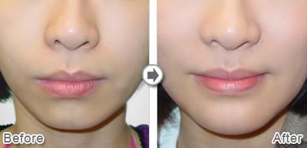 沈陽星美北順城醫(yī)療美容診所怎么樣？沈陽星美北順城醫(yī)療美容診所簡介|醫(yī)生團隊|口碑評價！