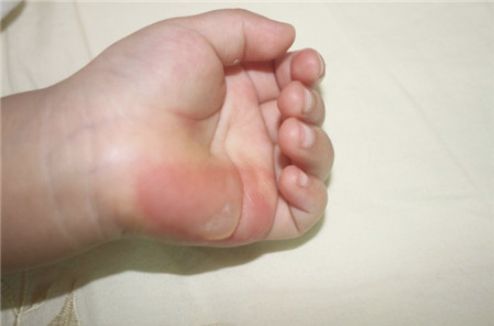 雙眼皮手術(shù)武漢哪家醫(yī)院好？熱門(mén)推薦及口碑解讀