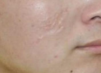 合肥整容醫(yī)生綜合排名TOP5，獨(dú)具經(jīng)驗(yàn)與在線咨詢服務(wù)