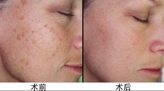 上海假體隆胸醫(yī)師推薦！王濤、亓發(fā)芝、劉天一帶您尋找完美曲線！