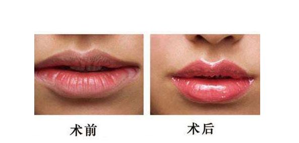 江蘇哪家醫(yī)院做激光祛斑好？