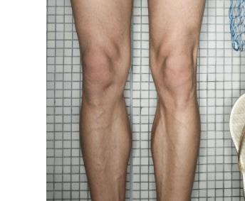 李楊西京醫(yī)院手術(shù)專家，助您完美小拉皮