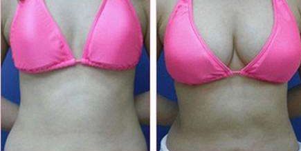 昆明哪家醫(yī)院的光子嫩膚祛斑效果好？